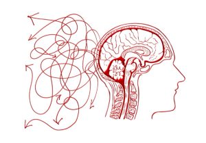 Rối loạn thần kinh chức năng