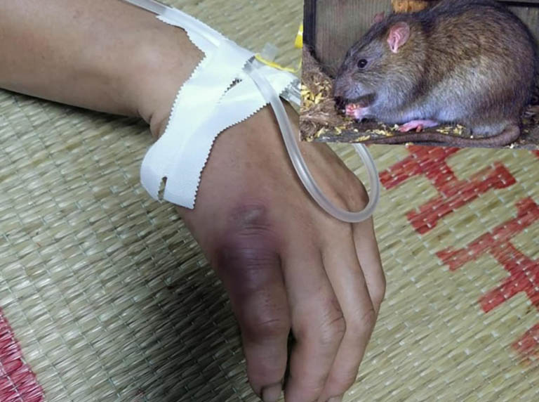 Hội chứng sợ chuột