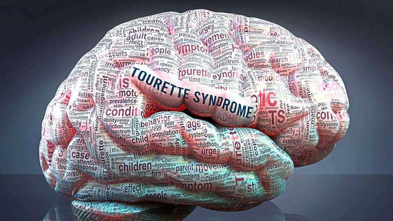 Hội chứng Tourette nguyên nhân